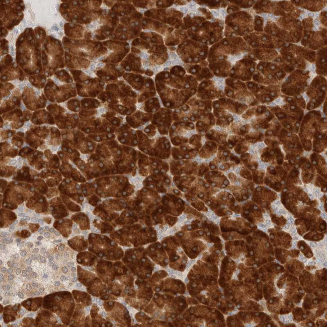 HRD1 Antibody in Immunohistochemistry (Paraffin) (IHC (P))