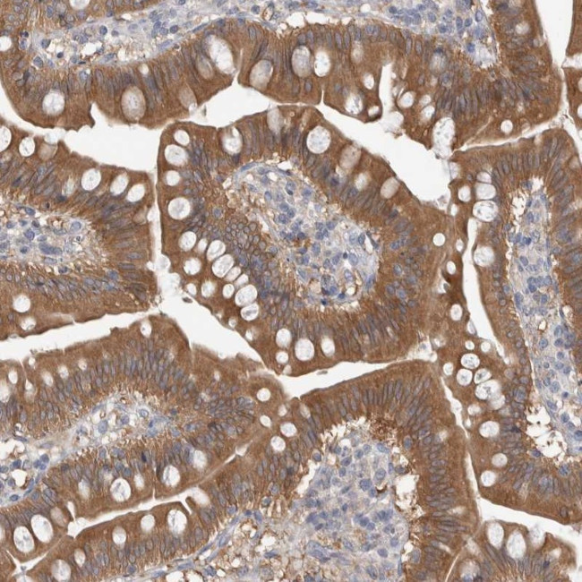 TIP30 Antibody in Immunohistochemistry (Paraffin) (IHC (P))