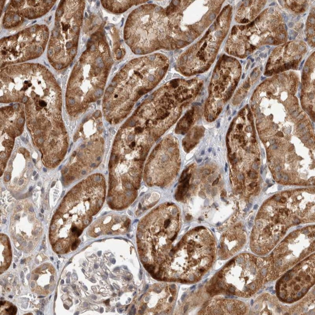 INSRR Antibody in Immunohistochemistry (Paraffin) (IHC (P))