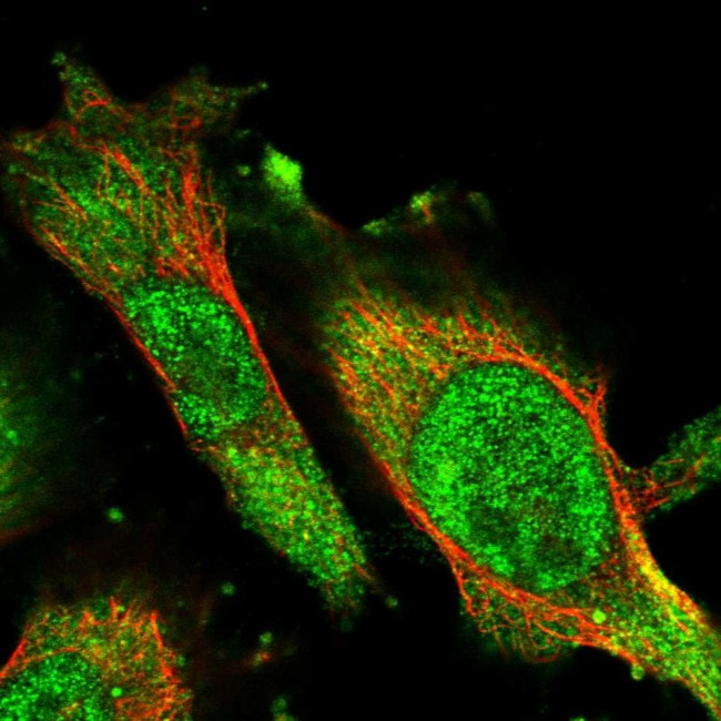 ACAT2 Antibody in Immunocytochemistry (ICC/IF)