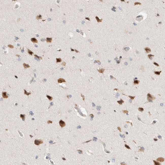 TCF4 Antibody in Immunohistochemistry (Paraffin) (IHC (P))