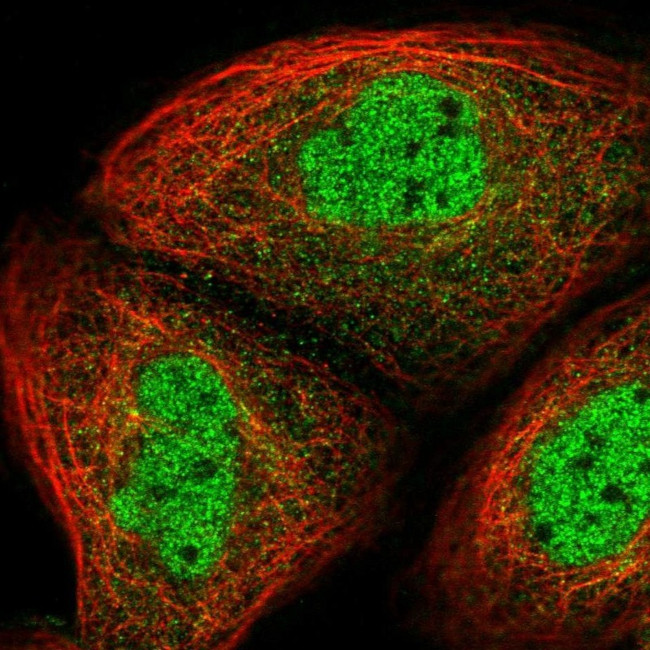 UHRF2 Antibody in Immunocytochemistry (ICC/IF)