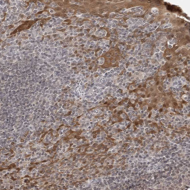 14-3-3 gamma Antibody in Immunohistochemistry (Paraffin) (IHC (P))