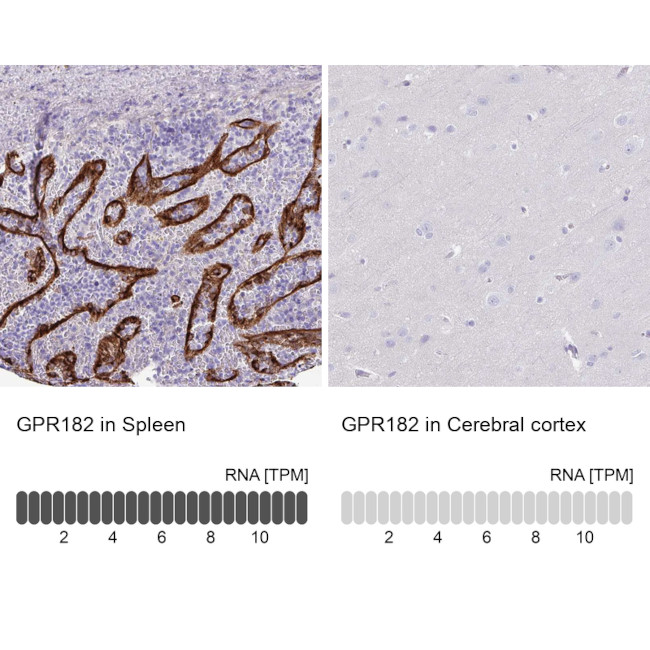 GPR182 Antibody in Immunohistochemistry (Paraffin) (IHC (P))