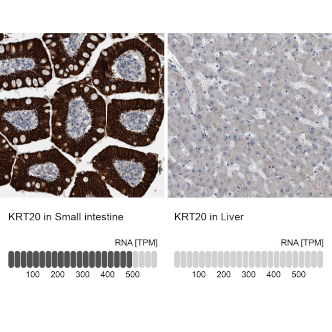 Cytokeratin 20 Antibody in Immunohistochemistry (Paraffin) (IHC (P))