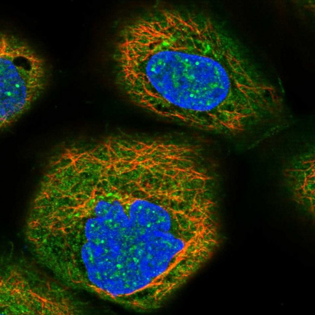 FAS Antibody in Immunocytochemistry (ICC/IF)