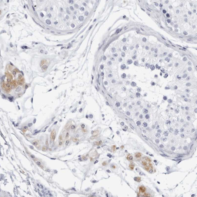 Fibrinogen gamma Antibody in Immunohistochemistry (Paraffin) (IHC (P))