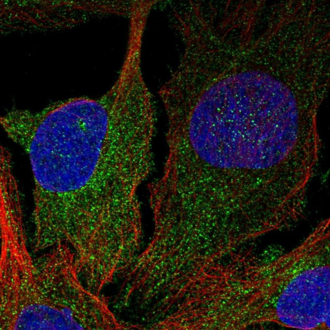 DGKD Antibody in Immunocytochemistry (ICC/IF)