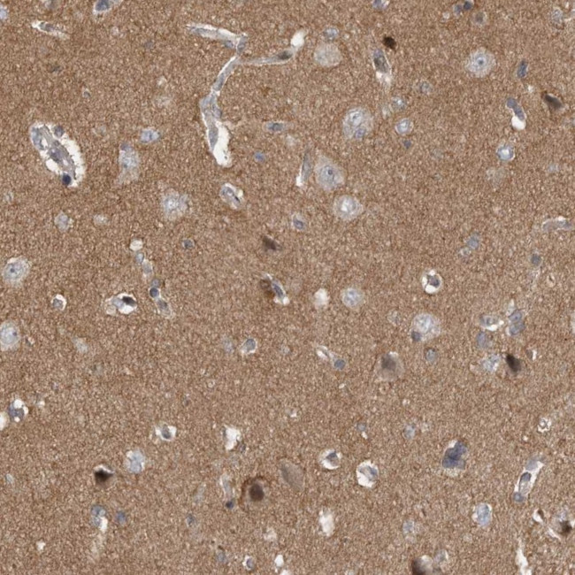 PPP1R9A Antibody in Immunohistochemistry (Paraffin) (IHC (P))