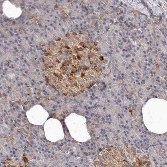 Bax Antibody in Immunohistochemistry (Paraffin) (IHC (P))