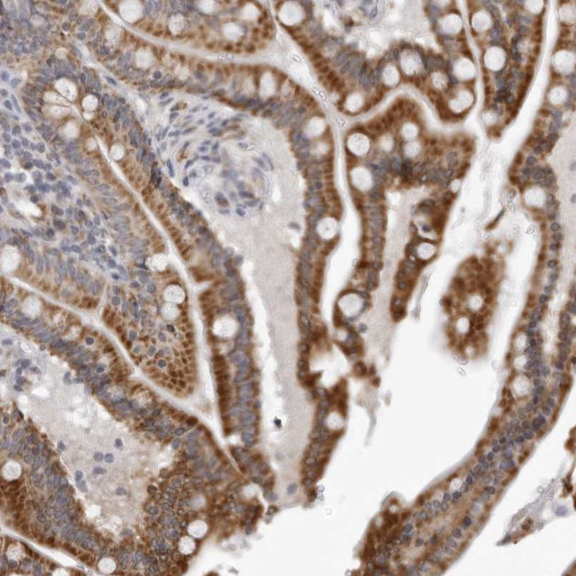 CPT2 Antibody in Immunohistochemistry (Paraffin) (IHC (P))