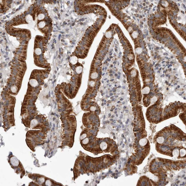 CPT2 Antibody in Immunohistochemistry (Paraffin) (IHC (P))