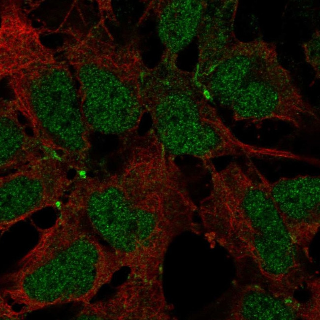 JAM2 Antibody in Immunocytochemistry (ICC/IF)