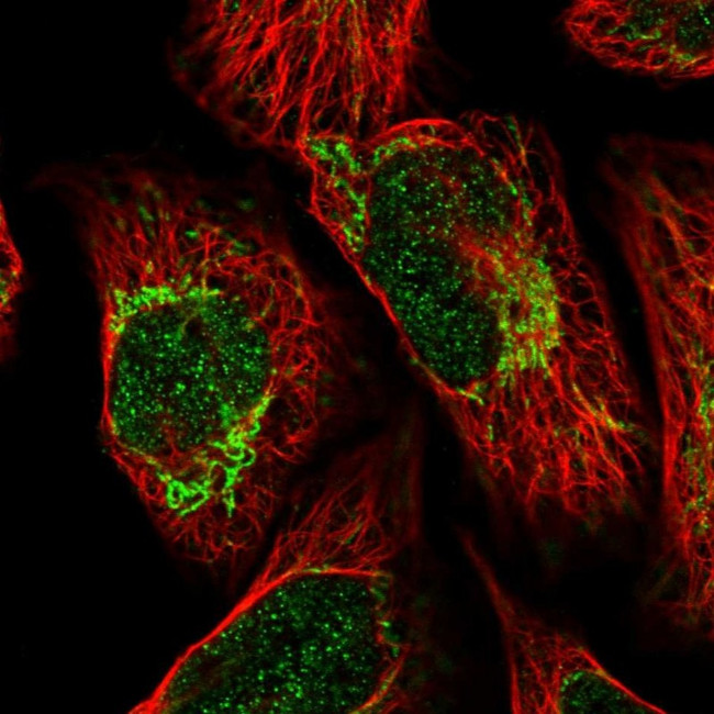 ALDH6A1 Antibody in Immunocytochemistry (ICC/IF)