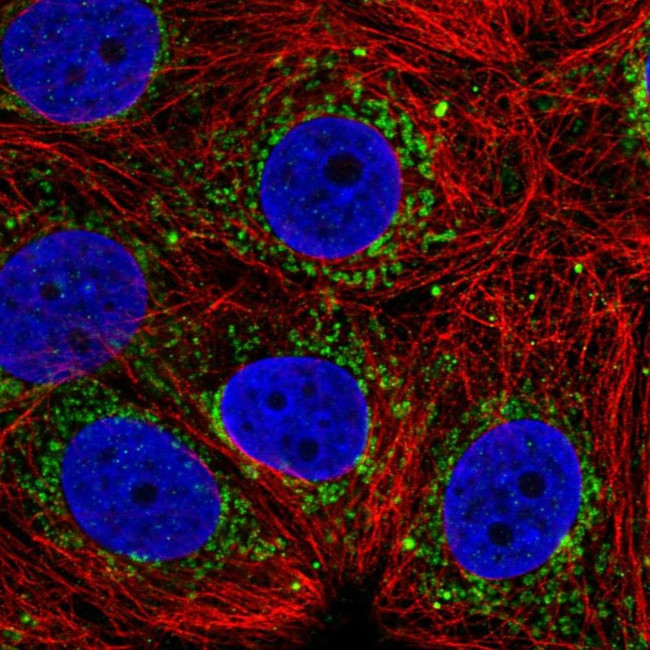 ALDH6A1 Antibody in Immunocytochemistry (ICC/IF)