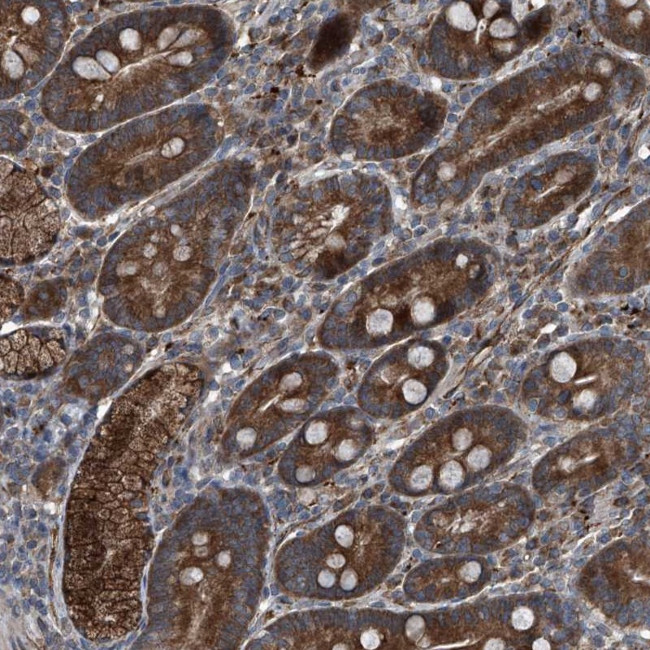 SENP2 Antibody in Immunohistochemistry (Paraffin) (IHC (P))