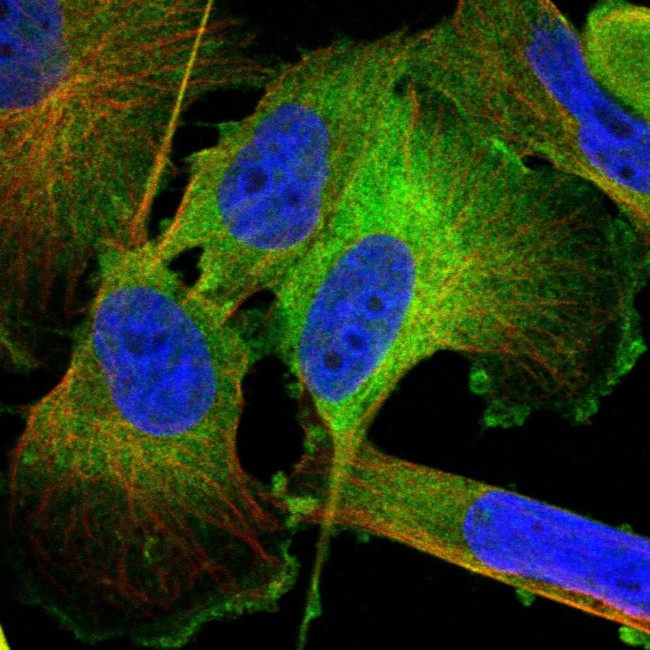 TGM2 Antibody in Immunocytochemistry (ICC/IF)