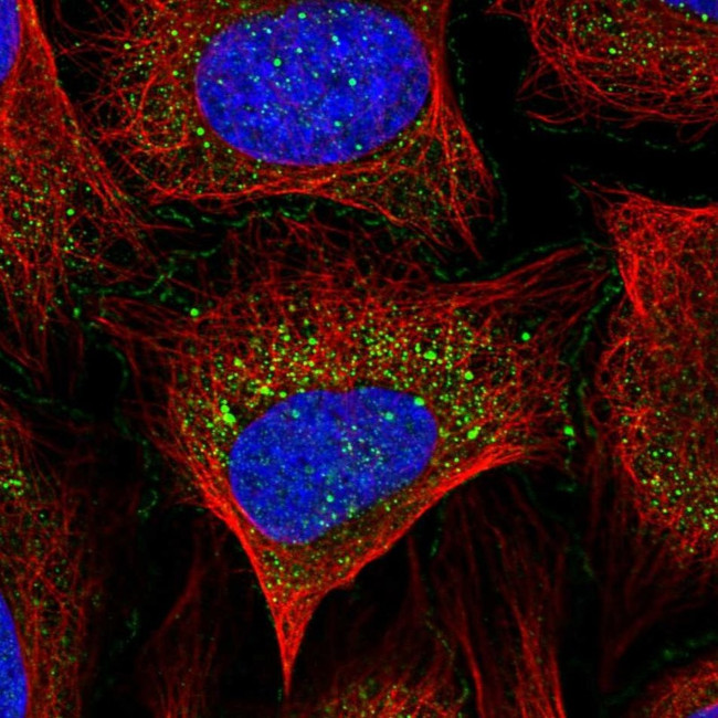 ABI1 Antibody in Immunocytochemistry (ICC/IF)