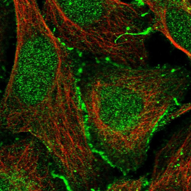 CAR Antibody in Immunocytochemistry (ICC/IF)