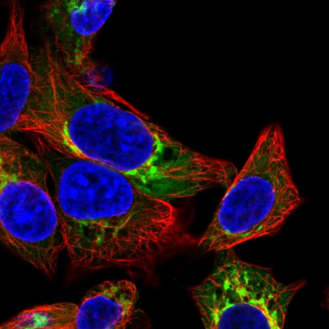 Albumin Antibody in Immunocytochemistry (ICC/IF)