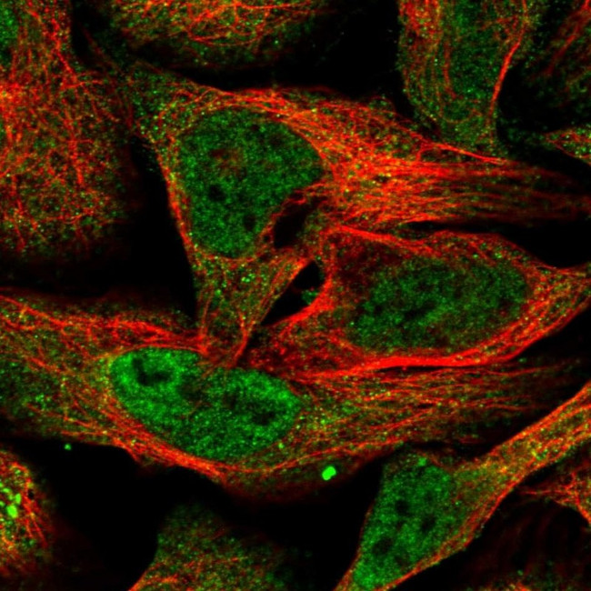 BTRC Antibody in Immunocytochemistry (ICC/IF)