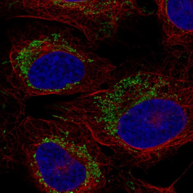 CCR7 Antibody in Immunocytochemistry (ICC/IF)