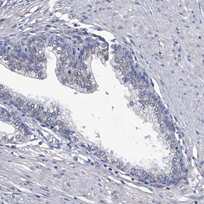 ABCG1 Antibody in Immunohistochemistry (Paraffin) (IHC (P))