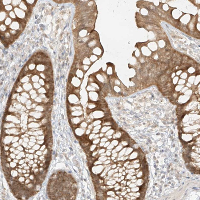 MIPEP Antibody in Immunohistochemistry (Paraffin) (IHC (P))