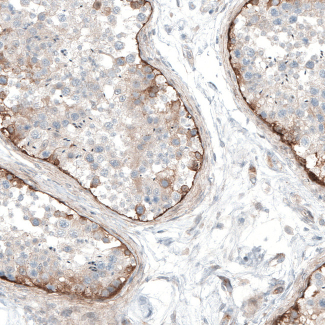 Laminin alpha-1 Antibody in Immunohistochemistry (Paraffin) (IHC (P))