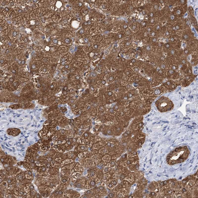 UGP2 Antibody in Immunohistochemistry (Paraffin) (IHC (P))