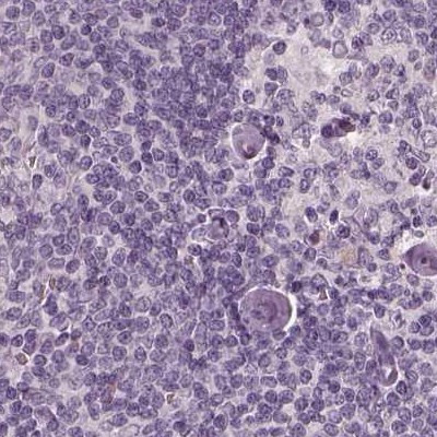 Opticin Antibody in Immunohistochemistry (Paraffin) (IHC (P))