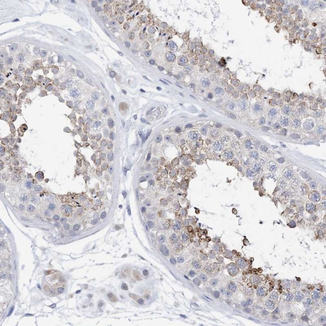 PLK4 Antibody in Immunohistochemistry (Paraffin) (IHC (P))