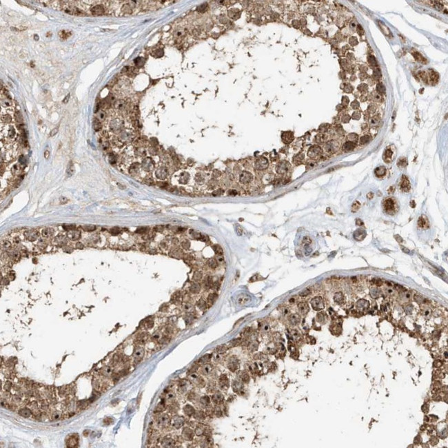 ABCB9 Antibody in Immunohistochemistry (Paraffin) (IHC (P))