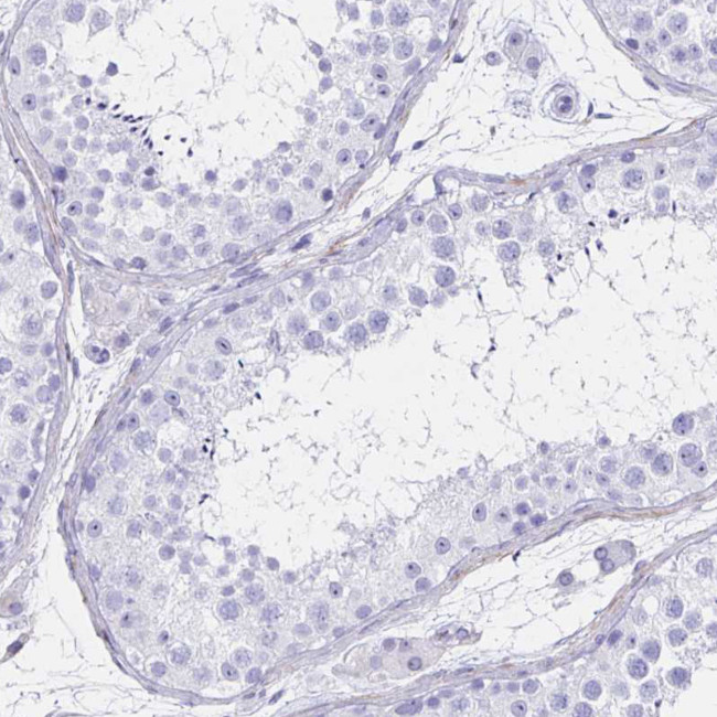 IKAROS Antibody in Immunohistochemistry (Paraffin) (IHC (P))