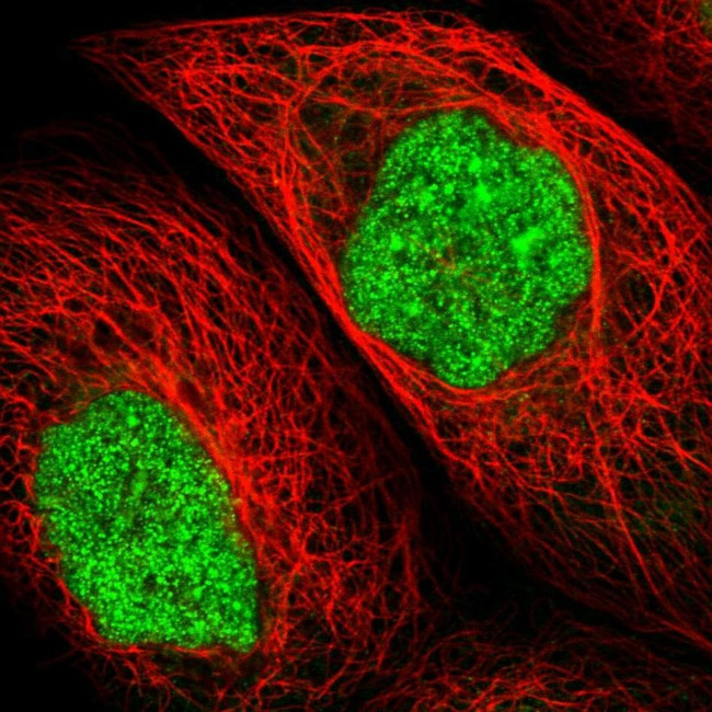 UPP2 Antibody in Immunocytochemistry (ICC/IF)