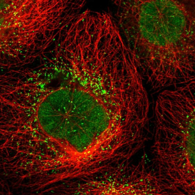 UPP2 Antibody in Immunocytochemistry (ICC/IF)