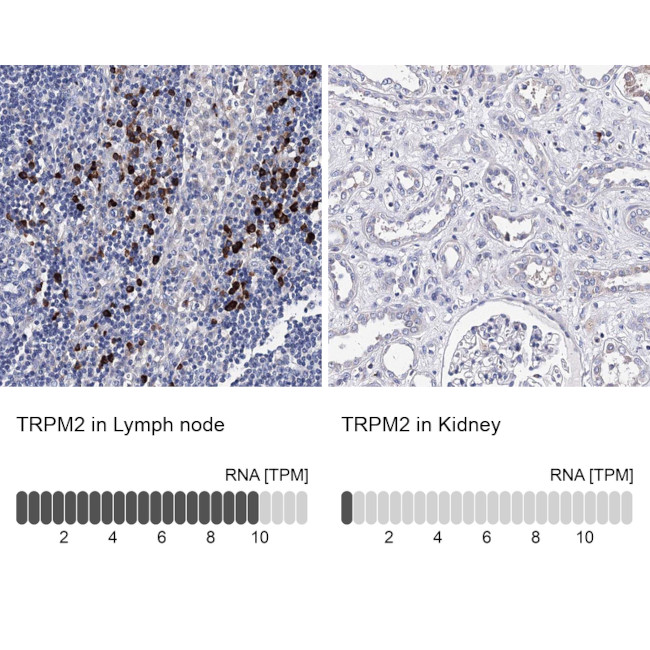 TRPM2 Antibody in Immunohistochemistry (Paraffin) (IHC (P))