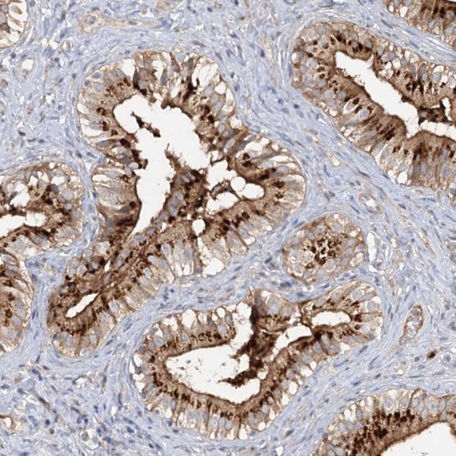 FGF19 Antibody in Immunohistochemistry (Paraffin) (IHC (P))