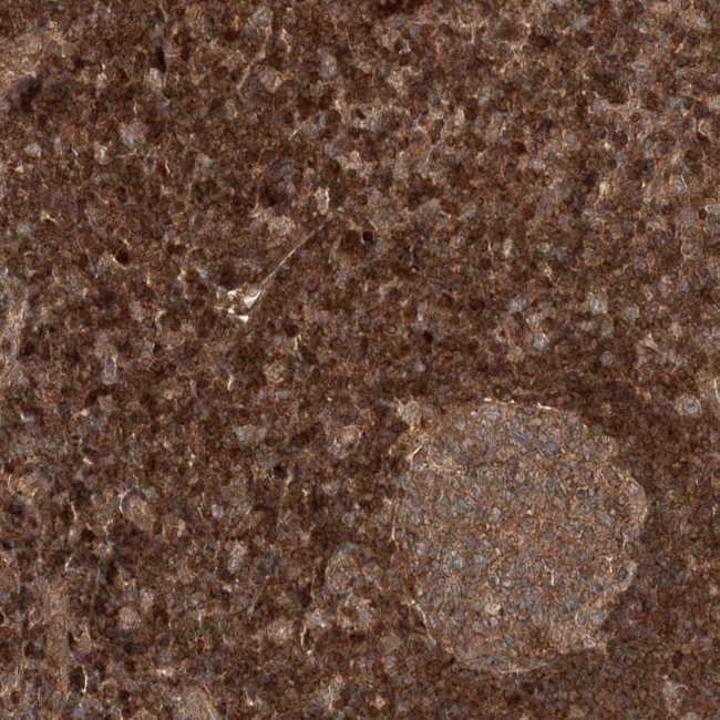 ALS2CR1 Antibody in Immunohistochemistry (Paraffin) (IHC (P))