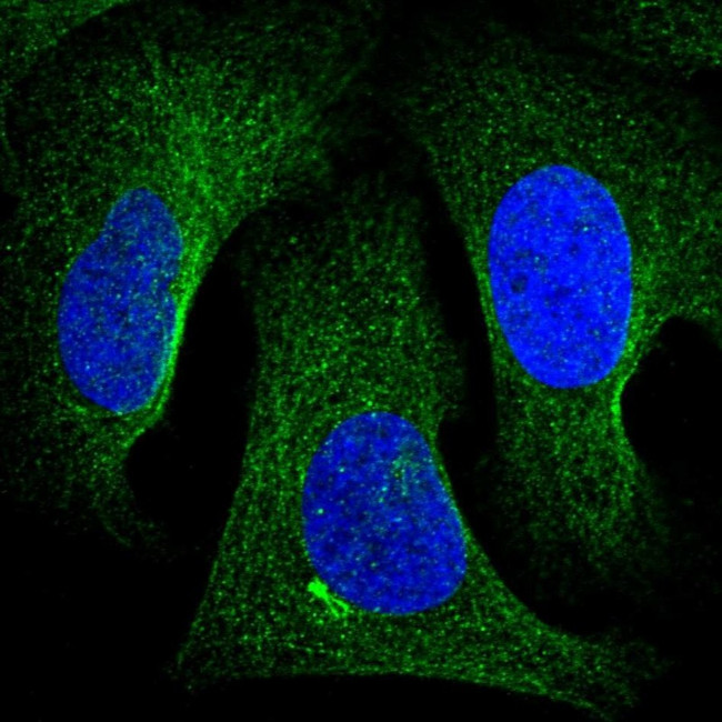 Tankyrase 2 Antibody in Immunocytochemistry (ICC/IF)