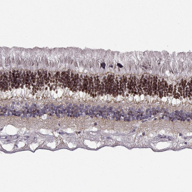 CRX Antibody in Immunohistochemistry (Paraffin) (IHC (P))