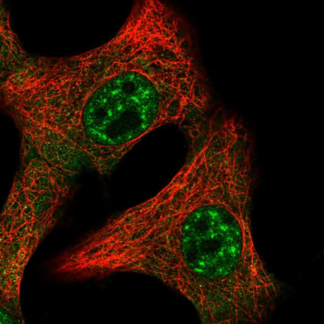 IL-15 Antibody in Immunocytochemistry (ICC/IF)