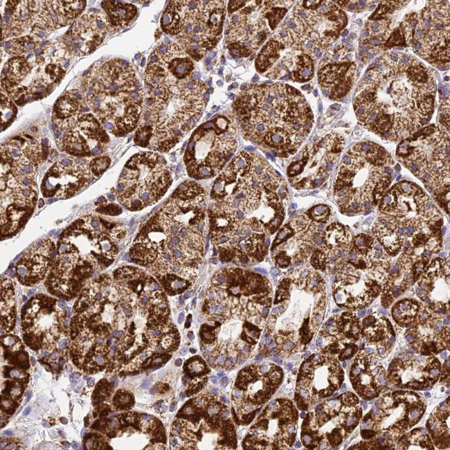 DRAK1 Antibody in Immunohistochemistry (Paraffin) (IHC (P))