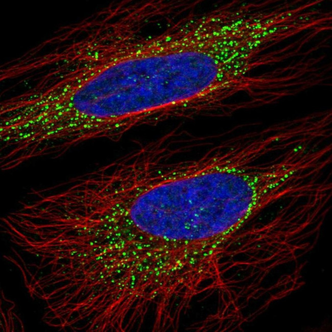 ORP5 Antibody in Immunocytochemistry (ICC/IF)