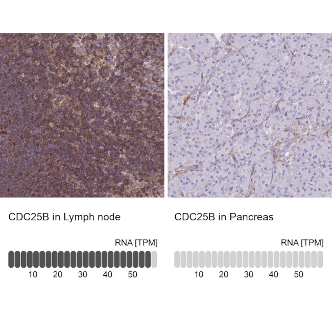 CDC25B Antibody in Immunohistochemistry (Paraffin) (IHC (P))