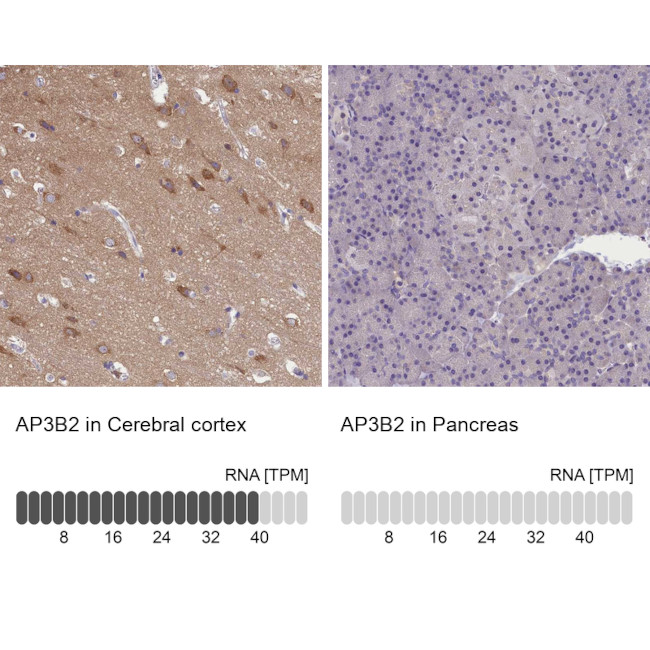 AP3B2 Antibody in Immunohistochemistry (Paraffin) (IHC (P))