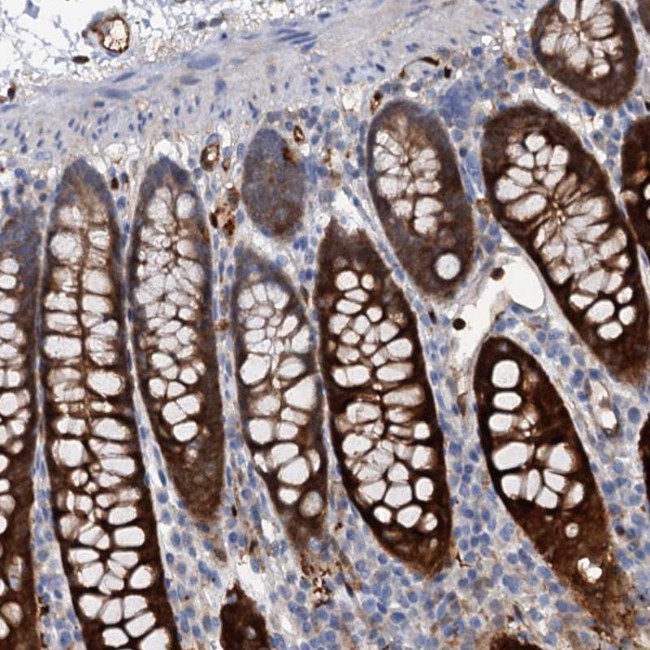 IL17RD Antibody in Immunohistochemistry (Paraffin) (IHC (P))