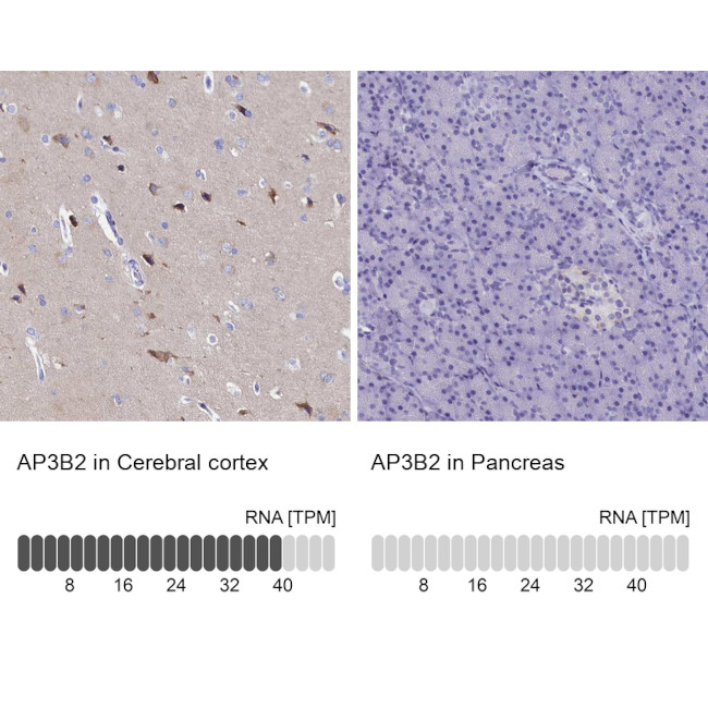 AP3B2 Antibody in Immunohistochemistry (Paraffin) (IHC (P))