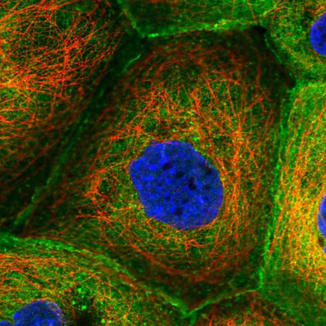 Coronin 1B Antibody in Immunocytochemistry (ICC/IF)