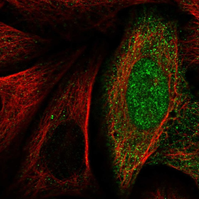 TALDO1 Antibody in Immunocytochemistry (ICC/IF)